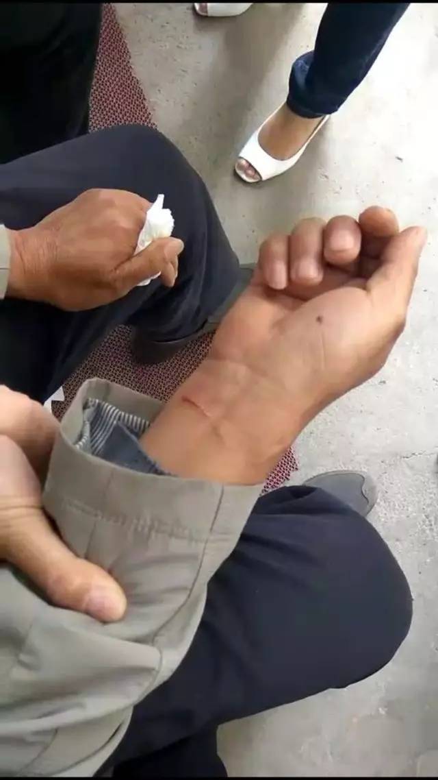 滚球预测赛后采访曝光，内幕引发热议